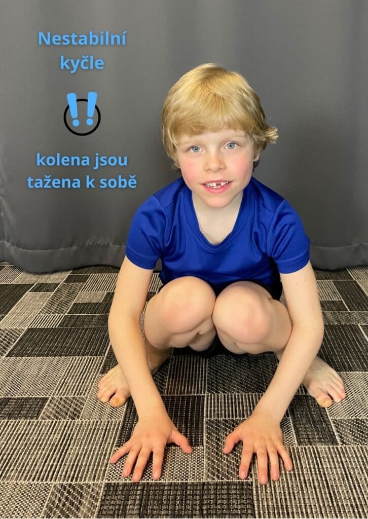 Test dřepu — kolena jsou tažena k sobě